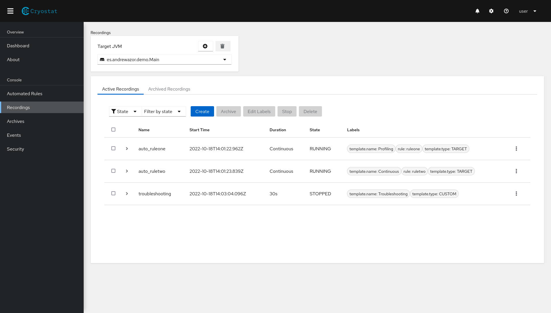 cryostat filter listed recordings 1